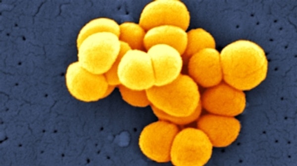 US government and private investors —like the Bill and Melinda Gates Foundation— are teaming up f...